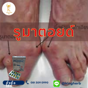 รูมาตอยด์